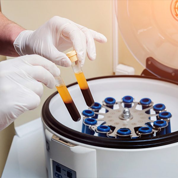 siskevi-cgf-afksitikoi-paragontes-odontiatriki-mesitherapia